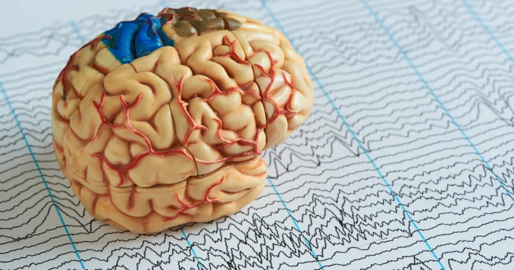 Comment accompagner l’épilepsie ? Le rôle clé de la psychomotricité
